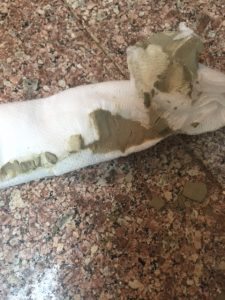 The gauze with hardened bentonite clay after it was removed from the infected thumb