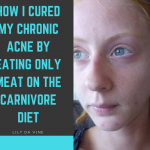 How I cured my chronic acne by eating only meat on the carnivore diet